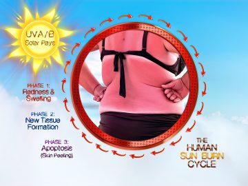 M&M_S21E06_Dr Chanda Siddoo-Atwal_Human Sun Burn Cycle