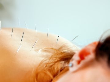 M&M_S23E02_Shirley Estey_Difference Between Acupunture & Intramuscular Stimulation
