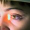 3 Types of Laser Eye Surgery